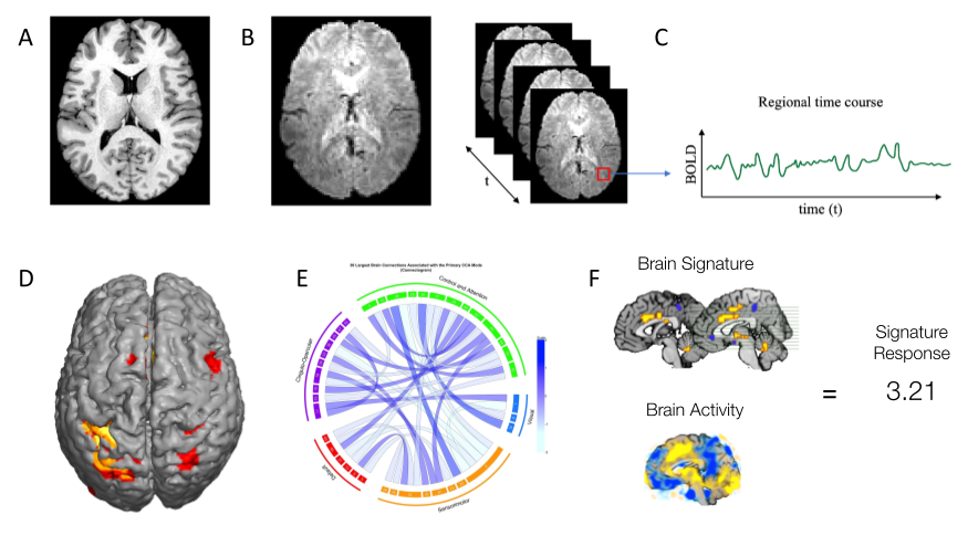 func_brain